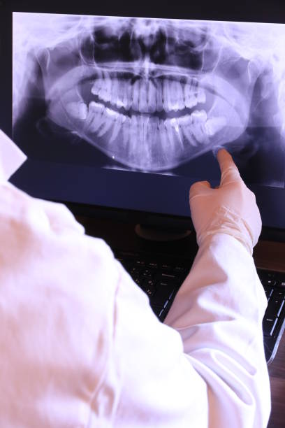 Best Dental Abscess Treatment in Moorefield, WV