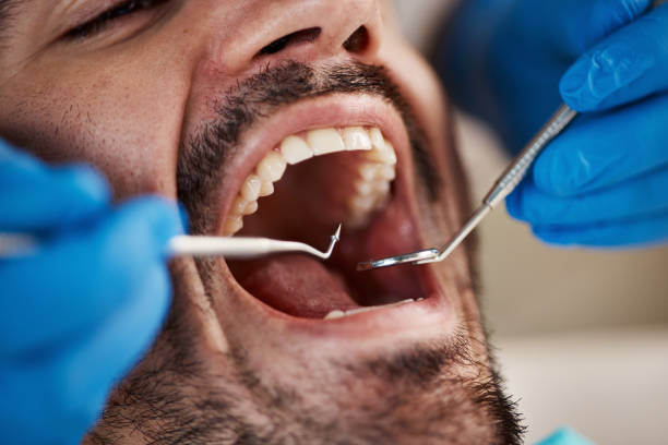 Best Weekend Emergency Dental Services in Moorefield, WV